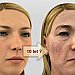 Test ml�d� - Zjist�te, jak budete vypadat za 10 let!