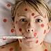 Ne�tovice - naka�liv� virov� onemocn�n�